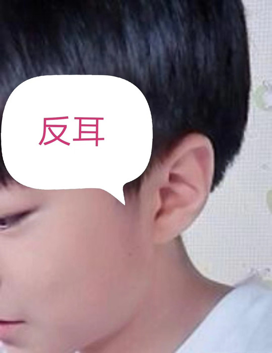 有的孩子生下来耳朵一大一小,一厚一薄,一高一低.
